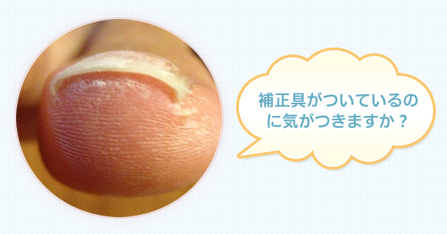 補正具がついているのに気がつきますか?